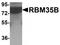 RBM35B antibody, TA320024, Origene, Western Blot image 