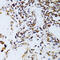TAPA antibody, 14-943, ProSci, Immunohistochemistry paraffin image 