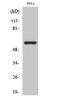 Cholinergic Receptor Nicotinic Alpha 3 Subunit antibody, STJ91447, St John