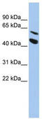 Matrix metalloproteinase-24 antibody, TA341854, Origene, Western Blot image 
