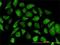Annexin A2 antibody, H00000302-M02, Novus Biologicals, Immunocytochemistry image 