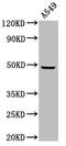 Myc-associated zinc finger protein antibody, LS-C670713, Lifespan Biosciences, Western Blot image 