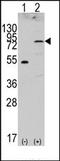 Fibroblast Growth Factor Receptor 4 antibody, AP14344PU-N, Origene, Western Blot image 