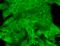 Potassium Sodium-Activated Channel Subfamily T Member 2 antibody, SMC-324D-A655, StressMarq, Immunocytochemistry image 