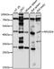 RNA Pseudouridine Synthase D4 antibody, 16-096, ProSci, Western Blot image 