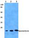 Spasmolytic polypeptide antibody, A07013, Boster Biological Technology, Western Blot image 
