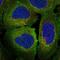 MER Proto-Oncogene, Tyrosine Kinase antibody, HPA075622, Atlas Antibodies, Immunofluorescence image 