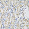 Vacuolar Protein Sorting 4 Homolog A antibody, LS-C346226, Lifespan Biosciences, Immunohistochemistry frozen image 