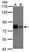 Caldesmon 1 antibody, PA5-27719, Invitrogen Antibodies, Western Blot image 