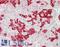 Sialyl Lewis a antibody, LS-C122776, Lifespan Biosciences, Immunohistochemistry paraffin image 