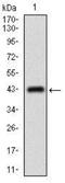 ATP Binding Cassette Subfamily C Member 4 antibody, NBP2-37350, Novus Biologicals, Western Blot image 