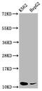 Small Nuclear Ribonucleoprotein Polypeptide E antibody, CSB-PA022336LA01HU, Cusabio, Western Blot image 