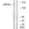 Ubiquitin Specific Peptidase 42 antibody, A10046, Boster Biological Technology, Western Blot image 
