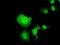 Chromosome 16 Open Reading Frame 72 antibody, NBP2-02850, Novus Biologicals, Immunocytochemistry image 