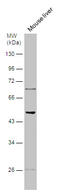 5-Hydroxytryptamine Receptor 2B antibody, GTX129900, GeneTex, Western Blot image 