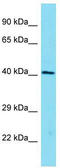 Eukaryotic translation initiation factor 4B antibody, TA343151, Origene, Western Blot image 