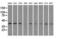 Mitogen-Activated Protein Kinase 1 antibody, GTX84151, GeneTex, Western Blot image 