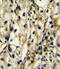 Branched Chain Amino Acid Transaminase 1 antibody, abx025607, Abbexa, Immunohistochemistry frozen image 