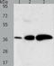 Aldo-keto reductase family 1 member C1 antibody, TA323179, Origene, Western Blot image 