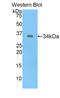 Metallothionein 1E antibody, LS-C300185, Lifespan Biosciences, Western Blot image 