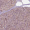G3BP Stress Granule Assembly Factor 1 antibody, HPA004052, Atlas Antibodies, Immunohistochemistry paraffin image 