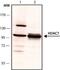 Histone Deacetylase 7 antibody, GTX12174, GeneTex, Western Blot image 