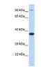 Bardet-Biedl Syndrome 5 antibody, NBP1-55191, Novus Biologicals, Western Blot image 
