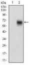 Beta-Secretase 1 antibody, NBP2-37261, Novus Biologicals, Western Blot image 
