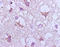 BAX antibody, 250843, Abbiotec, Immunohistochemistry paraffin image 