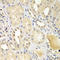 Ubiquitin Conjugating Enzyme E2 Z antibody, LS-C346400, Lifespan Biosciences, Immunohistochemistry frozen image 