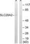 Solute Carrier Family 28 Member 2 antibody, TA314866, Origene, Western Blot image 