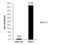 Protein Arginine Methyltransferase 7 antibody, GTX116570, GeneTex, Chromatin Immunoprecipitation image 