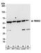 RNA Binding Motif Protein 22 antibody, A303-924A, Bethyl Labs, Western Blot image 
