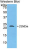 ARP antibody, LS-C295353, Lifespan Biosciences, Western Blot image 