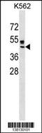 RING finger protein 204 antibody, 59-835, ProSci, Western Blot image 