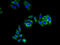 Chromosome 3 Open Reading Frame 18 antibody, A68130-100, Epigentek, Immunofluorescence image 