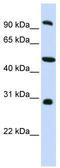 Echinoderm microtubule-associated protein-like 1 antibody, TA339952, Origene, Western Blot image 