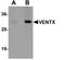 Homeobox protein VENTX antibody, A12772, Boster Biological Technology, Western Blot image 
