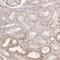 Zinc Finger Protein 852 antibody, HPA048312, Atlas Antibodies, Immunohistochemistry paraffin image 