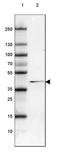 3-ketoacyl-CoA thiolase, peroxisomal antibody, NBP2-42383, Novus Biologicals, Western Blot image 