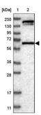 Coiled-Coil Domain Containing 155 antibody, NBP1-81992, Novus Biologicals, Western Blot image 