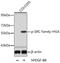 SRC Proto-Oncogene, Non-Receptor Tyrosine Kinase antibody, GTX54701, GeneTex, Western Blot image 