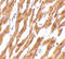 N-Acylsphingosine Amidohydrolase 1 antibody, OAPB00726, Aviva Systems Biology, Immunohistochemistry frozen image 