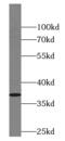 Annexin A8 antibody, FNab00440, FineTest, Western Blot image 