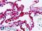 SS18 Subunit Of BAF Chromatin Remodeling Complex antibody, LS-B9154, Lifespan Biosciences, Immunohistochemistry frozen image 