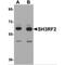 Putative E3 ubiquitin-protein ligase SH3RF2 antibody, MBS151521, MyBioSource, Western Blot image 