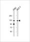 Lethal(2) giant larvae protein homolog 2 antibody, 61-228, ProSci, Western Blot image 
