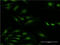 Ribosomal Protein S29 antibody, LS-C198132, Lifespan Biosciences, Immunofluorescence image 