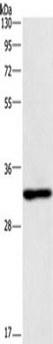 Kdap antibody, TA349495, Origene, Western Blot image 