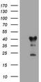 Transmembrane Protein 173 antibody, TA505022S, Origene, Western Blot image 